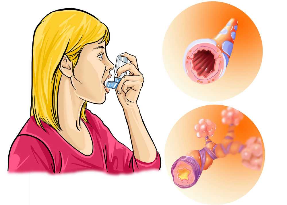 Вдыхание пыли: вред и болезни