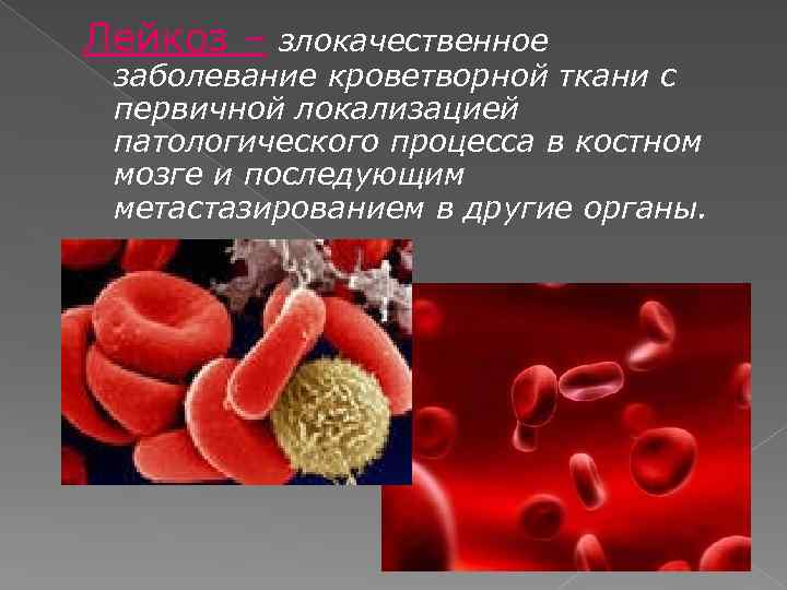 Болезни крови и кроветворных органов. Опухолевые заболевания кроветворной ткани. Злокачественные заболевания крови.