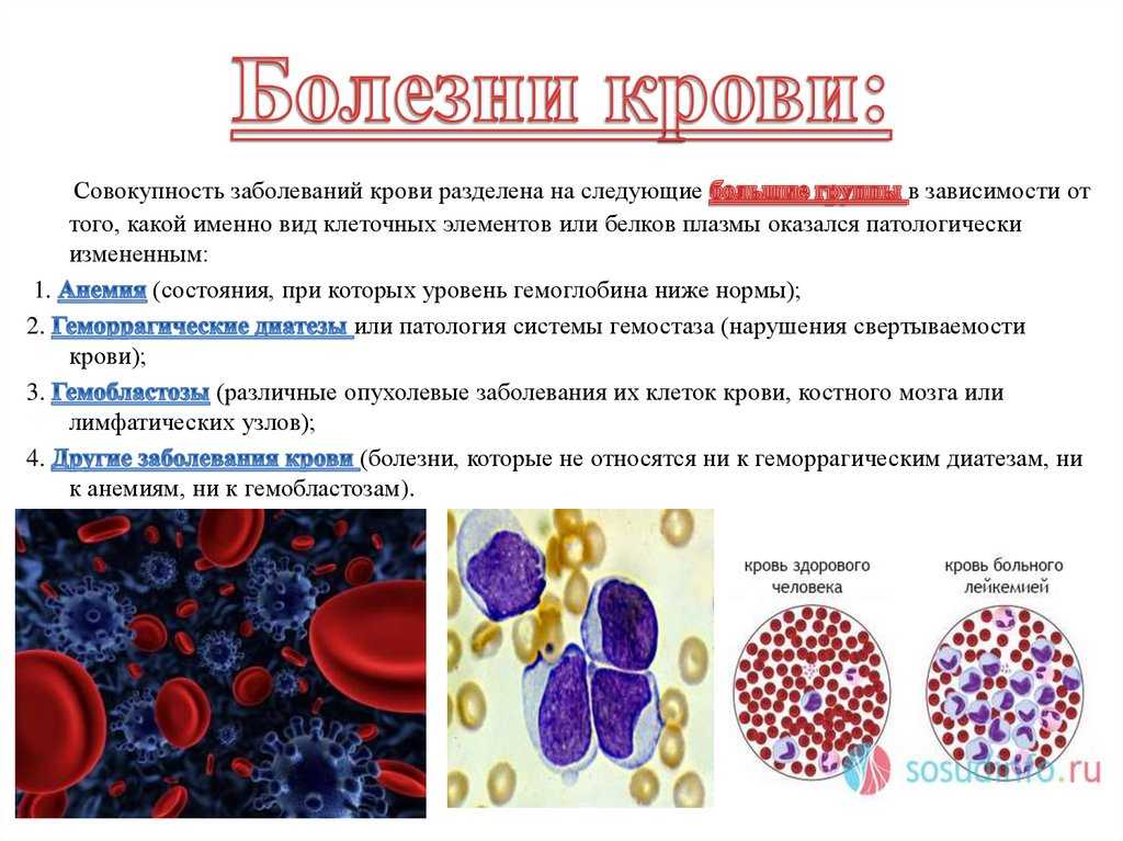 Болезни системы кроветворения. Заболевания крови и кроветворных органов. Болезни крови и кроветворных органов