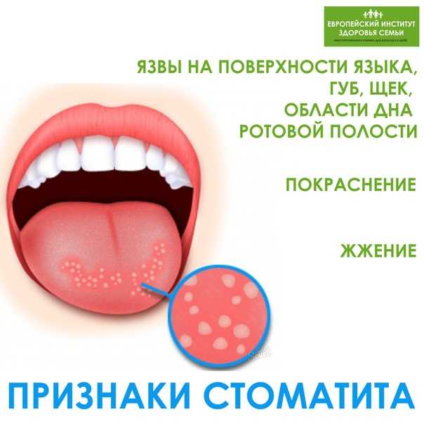 Покажи себе язык. о каких болезнях предупреждает «мышечный гидростат». новости общества