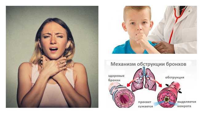 Кашель курильщика: симптомы и лечение