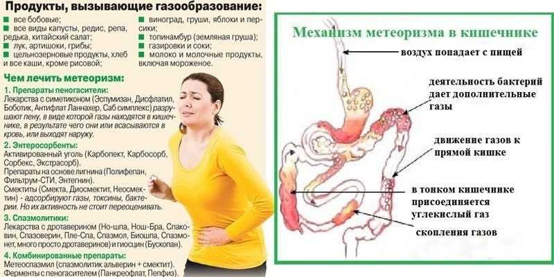 Расстройство пищеварения желудочно-кишечного тракта: диспепсия