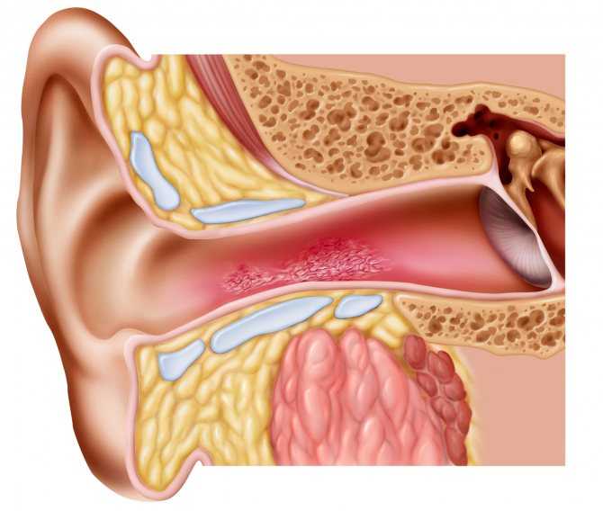 Шум в ушах и голове. причины и лечение шума в ушах