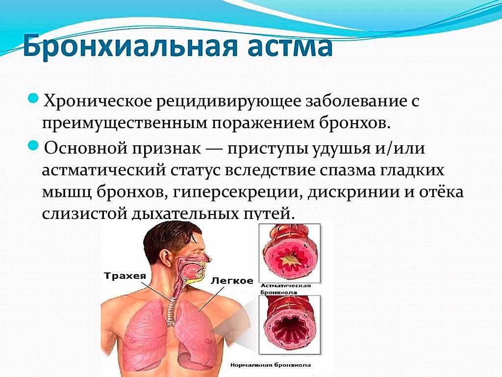 Болит горло: почему? боль в горле при температуре и без температуры. что делать, если заболело горло?